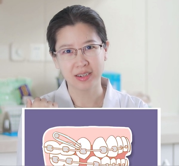 愛康健口腔|箍牙種植支抗釘有什麼作用