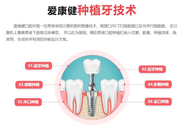 在做種植牙之前要不要先洗牙