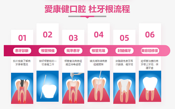請問深圳愛康健牙科杜牙根收費多少?