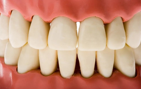 深圳愛康健牙科|牙齒矯正做片切對牙齒有傷害嗎？