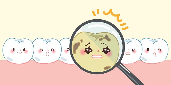 為什麼天天堅持早晚刷牙，怎麼還是會蛀牙？