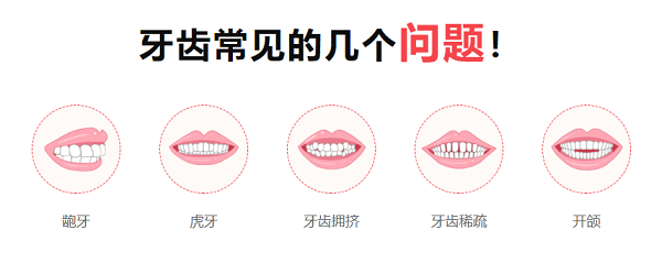 牙齒矯正的時間一般要多久?深圳愛康健牙繳納箍牙定金可參與3000-7000元減免優惠