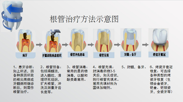 深圳補牙價格是多少