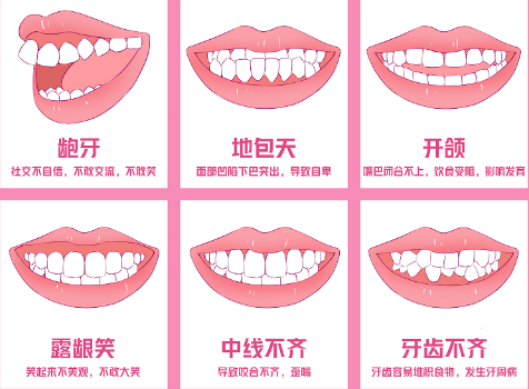 孩子有深覆合露牙齦問題怎麼糾正?愛康健齒科碩博牙醫領銜專註各種牙齒不齊矯正畸形問題
