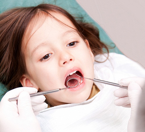 深圳拔乳牙多少錢一顆