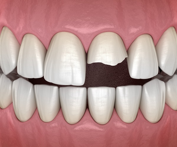 爛牙根長期不拔會怎樣