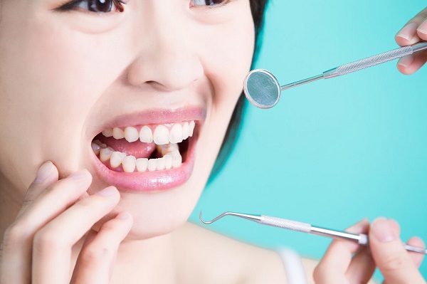 洗牙多少錢一次