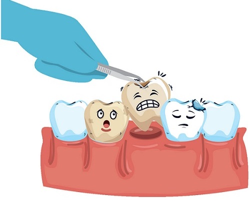 深圳脫大牙幾多錢