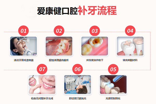 愛康健補牙全過程及步驟